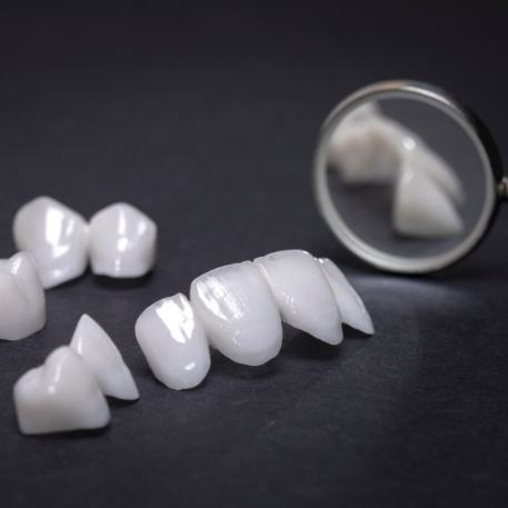 Several white dental crowns and veneers on table next to dental mirror