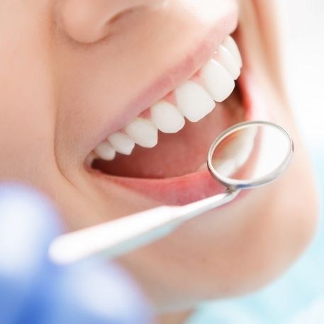 Dental mirror next to mouth with flawless teeth